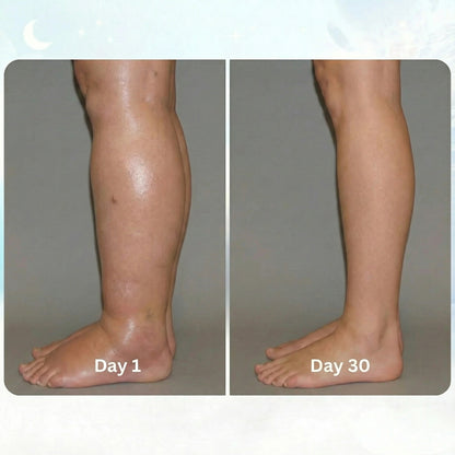 VASCORA - EMS FIX SWOLLEN LEGS FROM HOME